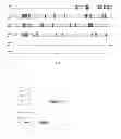 Fig. 05 - AGROCYBE AEGERITA LECTIN AAL-2, AND ENCODING GENE THEREOF, PREPARATION METHOD THEREFOR AND APPLICATION THEREOF