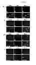 Fig. 04 - Modulation of radiation response using microrna
