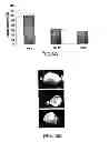 Fig. 04 - METHODS AND COMPOSITIONS FOR INHIBITING INTEGRINS USING TELLURIUM-CONTAINING COMPOUNDS