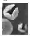 Fig. 14 - Non-spherical resin particles, manufacturing method thereof, and use thereof