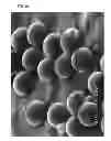 Fig. 21 - Non-spherical resin particles, manufacturing method thereof, and use thereof