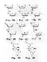 Fig. 03 - Immunosuppression compound and treatment method