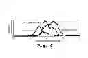 Fig. 08 - Immunosuppression compound and treatment method
