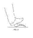 Fig. 13 - Portable Therapeutic Device Using Rotating Static Magnetic Fields