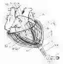 Fig. 01 - Implanting cardiac devices
