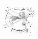 Fig. 03 - Implanting cardiac devices