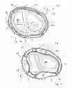 Fig. 05 - Implanting cardiac devices