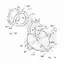 Fig. 13 - Implanting cardiac devices