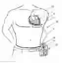 Fig. 01 - HEART SHEATH SYSTEM AND METHOD OF USE