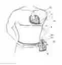Fig. 02 - HEART SHEATH SYSTEM AND METHOD OF USE
