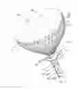 Fig. 09 - HEART SHEATH SYSTEM AND METHOD OF USE
