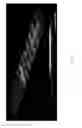 Fig. 08 - PIEZOELECTRIC-BASED, SELF-SUSTAINING ARTIFICIAL COCHLEA