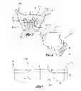 Fig. 02 - Method of treating incontinence