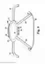 Fig. 09 - Method for supporting vaginal cuff