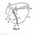 Fig. 10 - Method for supporting vaginal cuff