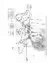 Fig. 06 - TROCAR, AND SURGERY ASSISTANCE SYSTEM