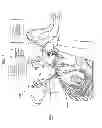 Fig. 07 - TROCAR, AND SURGERY ASSISTANCE SYSTEM
