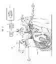 Fig. 08 - TROCAR, AND SURGERY ASSISTANCE SYSTEM