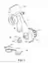 Fig. 02 - CLOSED SUCTION SET INSERTABLE WITH BRONCHOSCOPE