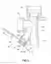 Fig. 04 - CLOSED SUCTION SET INSERTABLE WITH BRONCHOSCOPE
