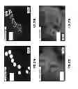 Fig. 35 - CHEMICALLY-SELECTIVE, LABEL FREE, MICROENDOSCOPIC SYSTEM BASED ON COHERENT ANTI-STOKES RAMAN SCATTERING