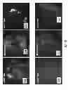 Fig. 69 - CHEMICALLY-SELECTIVE, LABEL FREE, MICROENDOSCOPIC SYSTEM BASED ON COHERENT ANTI-STOKES RAMAN SCATTERING