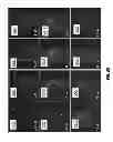 Fig. 74 - CHEMICALLY-SELECTIVE, LABEL FREE, MICROENDOSCOPIC SYSTEM BASED ON COHERENT ANTI-STOKES RAMAN SCATTERING