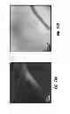 Fig. 80 - CHEMICALLY-SELECTIVE, LABEL FREE, MICROENDOSCOPIC SYSTEM BASED ON COHERENT ANTI-STOKES RAMAN SCATTERING