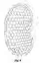 Fig. 04 - Abdominal retractor