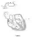 Fig. 07 - METHOD AND SYSTEM FOR HEART FAILURE STATUS EVALUATION BASED ON A DISORDERED BREATHING INDEX