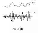 Fig. 13 - METHOD AND SYSTEM FOR HEART FAILURE STATUS EVALUATION BASED ON A DISORDERED BREATHING INDEX