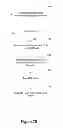Fig. 15 - METHOD AND SYSTEM FOR HEART FAILURE STATUS EVALUATION BASED ON A DISORDERED BREATHING INDEX