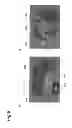 Fig. 09 - Brain disease diagnosis system