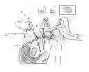 Fig. 01 - TROCAR, AND SURGERY ASSISTANCE SYSTEM