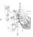 Fig. 07 - TROCAR, AND SURGERY ASSISTANCE SYSTEM