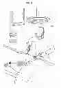 Fig. 08 - TROCAR, AND SURGERY ASSISTANCE SYSTEM