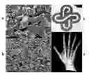 Fig. 01 - Bismuth particle X-ray contrast agents