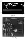 Fig. 06 - Bismuth particle X-ray contrast agents