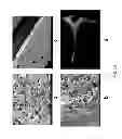 Fig. 08 - Bismuth particle X-ray contrast agents