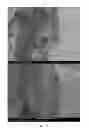 Fig. 09 - Bismuth particle X-ray contrast agents