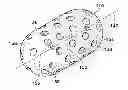 Fig. 01 - Subcutaneous cavity marking device and method
