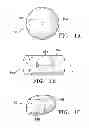 Fig. 02 - Subcutaneous cavity marking device and method