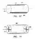 Fig. 06 - Subcutaneous cavity marking device and method