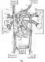 Fig. 02 - System and method for evaluating an electrophysiological signal