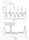 Fig. 08 - System and method for evaluating an electrophysiological signal