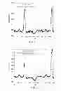 Fig. 09 - System and method for evaluating an electrophysiological signal