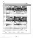 Fig. 07 - Method And System To Calculate  qEEG
