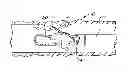 Fig. 01 - Precision directed medical instruments