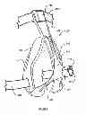 Fig. 03 - Method and device for apnea and hypopnea detection
