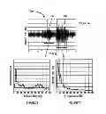 Fig. 08 - Method and device for apnea and hypopnea detection